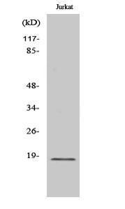 Western blot analysis of various cells using Anti-Cofilin Antibody