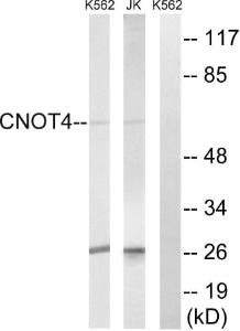 Western blot analysis of lysates from Jurkat and K562 cells using Anti-CNOT4 Antibody. The right hand lane represents a negative control, where the antibody is blocked by the immunising peptide