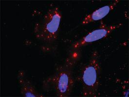 Anti-ETS1 + NFKB1 Antibody Pair