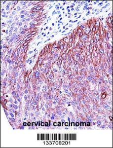 Anti-KRT6B Rabbit Polyclonal Antibody (AP (Alkaline Phosphatase))