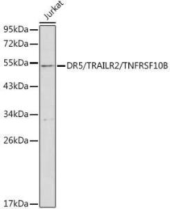 Western blot analysis of extracts of Jurkat cells, using Anti-DR5 Antibody (A8894) at 1:1,000 dilution. The secondary antibody was Goat Anti-Rabbit IgG HandL Antibody (HRP) at 1:10,000 dilution. Lysates/proteins were present at 25 µg per lane. The blocking buffer used was 3% non-fat dry milk in TBST