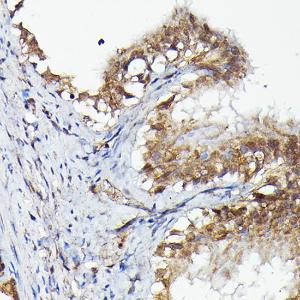 Immunohistochemistry analysis of paraffin-embedded rat fallopian tube using Anti-MNK1 Antibody (A309108) at a dilution of 1:50 (40x lens). Perform high pressure antigen retrieval with 10 mM citrate buffer pH 6.0 before commencing with IHC staining protocol.