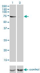 Anti-ABCF2 Mouse Monoclonal Antibody [clone: 1D11]