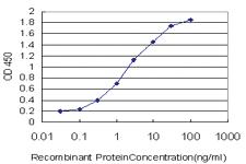 Anti-ATP2C1 Mouse Monoclonal Antibody [clone: 2G1]