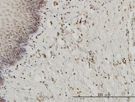 Anti-HYI Mouse Monoclonal Antibody [clone: 2A2]