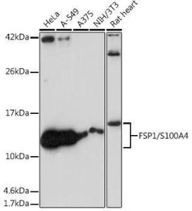 Western blot analysis of extracts of various cell lines, using Anti-S100A4 Antibody [ARC0475] (A305282) at 1:1,000 dilution