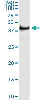 Anti-TWF1 Mouse Monoclonal Antibody [clone: 1E2]