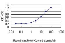 Anti-ABCF2 Mouse Monoclonal Antibody [clone: 1D11]