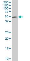 Anti-STK38 Mouse Monoclonal Antibody [clone: 2F3]