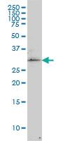 Anti-TP53RK Mouse Monoclonal Antibody [clone: 2A9]