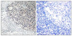 Immunohistochemical analysis of paraffin-embedded human tonsil tissue using Anti-Collagen IX alpha3 Antibody. The right hand panel represents a negative control, where the antibody was pre-incubated with the immunising peptide