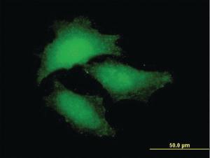 Anti-NF2 Mouse Polyclonal Antibody