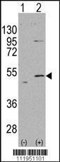 Anti-ALDH5A1 Rabbit Polyclonal Antibody (APC (Allophycocyanin))