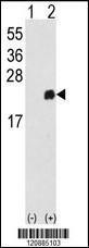 Anti-PRDX1 Rabbit Polyclonal Antibody