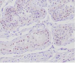 Immunohistochemical analysis of formalin-fixed, paraffin-embedded human testis tissue using Anti-AMH Antibody [AMH/300]