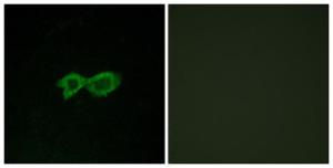 Immunofluorescence analysis of LOVO cells using Anti-OR13C4 Antibody. The right hand panel represents a negative control, where the Antibody was pre-incubated with the immunising peptide