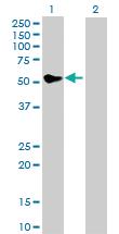 Anti-MMP13 Rabbit Polyclonal Antibody