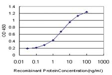 Anti-TWF1 Mouse Monoclonal Antibody [clone: 1E2]