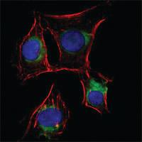 Anti-NGFR Mouse Monoclonal Antibody [clone: 2F1C2]