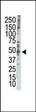 Anti-RAD9A Rabbit Polyclonal Antibody