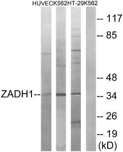 Western blot analysis of lysates from K56 HUVEC, and HT-29 cells using Anti-ZADH1 Antibody. The right hand lane represents a negative control, where the antibody is blocked by the immunising peptide.