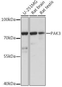 Western blot analysis of extracts of various cell lines, using Anti-PAK3 Antibody (A93107) at 1:1,000 dilution. The secondary antibody was Goat Anti-Rabbit IgG H&L Antibody (HRP) at 1:10,000 dilution.