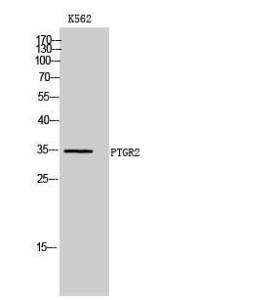 Western blot analysis of K562 cells using Anti-ZADH1 Antibody