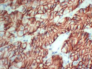 Immunohistochemical analysis of paraffin-embedded human Stomach-high magnification using Anti-Claudin 18 Antibody