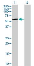 Anti-MAGEC2 Mouse Polyclonal Antibody