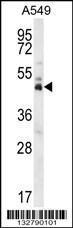 Anti-DUX4 Rabbit Polyclonal Antibody (PE (Phycoerythrin))