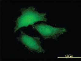 Anti-NF2 Mouse Polyclonal Antibody