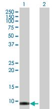 Anti-SMR3B Mouse Polyclonal Antibody