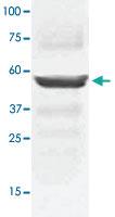 Anti-MAP2K5 Rabbit Polyclonal Antibody