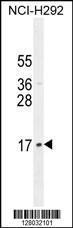 Anti-LLPH Rabbit Polyclonal Antibody (HRP (Horseradish Peroxidase))