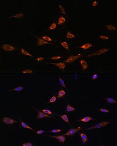 Immunofluorescence analysis of NIH-3T3 cells using Anti-PAK3 Antibody (A93107) at a dilution of 1:100. DAPI was used to stain the cell nuclei (blue).