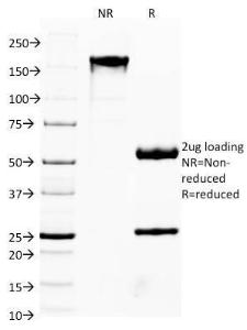 SDS-PAGE analysis of Anti-FOXA1 Antibody [FOXA1/1514] under non-reduced and reduced conditions; showing intact IgG and intact heavy and light chains, respectively. SDS-PAGE analysis confirms the integrity and purity of the antibody