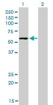 Anti-STK38 Mouse Monoclonal Antibody [clone: 2F3]