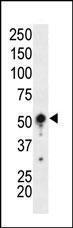 Anti-PRKAA1 Rabbit Polyclonal Antibody (HRP (Horseradish Peroxidase))