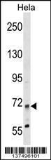 Anti-MTMR14 Rabbit Polyclonal Antibody (FITC (Fluorescein Isothiocyanate))