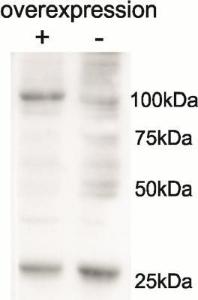 Cell line 143B overexpressing Human AARS2 and probed with Anti-AARS2 Antibody (A85030) (mock transfection in second lane)