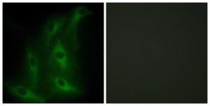 Anti-Collagen IV alpha6 antibody