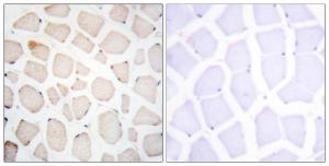 Immunohistochemical analysis of paraffin-embedded human skeletal muscle tissue using Anti-Clock Antibody. The right hand panel represents a negative control, where the antibody was pre-incubated with the immunising peptide.