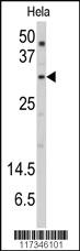 Anti-SNURF Rabbit Polyclonal Antibody