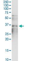 Anti-SMN2 Polyclonal Antibody Pair