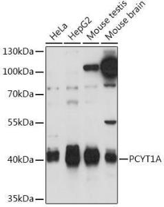 Western blot analysis of extracts of various cell lines, using Anti-CT A Antibody (A93109) at 1:1,000 dilution The secondary antibody was Goat Anti-Rabbit IgG H&L Antibody (HRP) at 1:10,000 dilution Lysates/proteins were present at 25 µg per lane