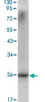 Anti-NKX3-1 Mouse Monoclonal Antibody [clone: 4H4]