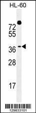 Anti-DUX4 Rabbit Polyclonal Antibody (FITC (Fluorescein Isothiocyanate))