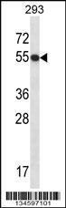 Anti-GTF2E1 Rabbit Polyclonal Antibody (FITC (Fluorescein Isothiocyanate))