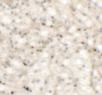 Anti-NKX2-6 Rabbit Polyclonal Antibody