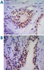 Anti-NKX3-1 Mouse Monoclonal Antibody [clone: 4H4]